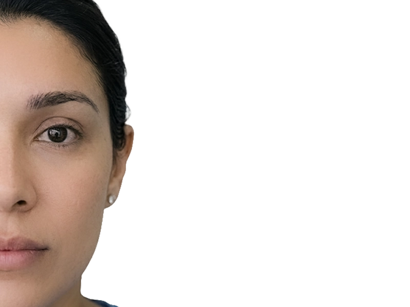 Levantamiento de cejas